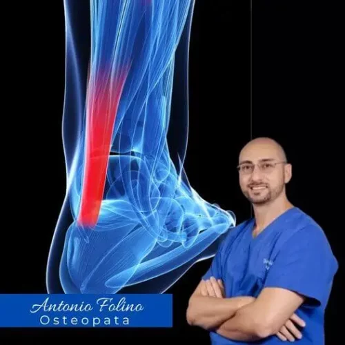 Tendine d’achille e osteopatia Tendine d'achille e osteopatia